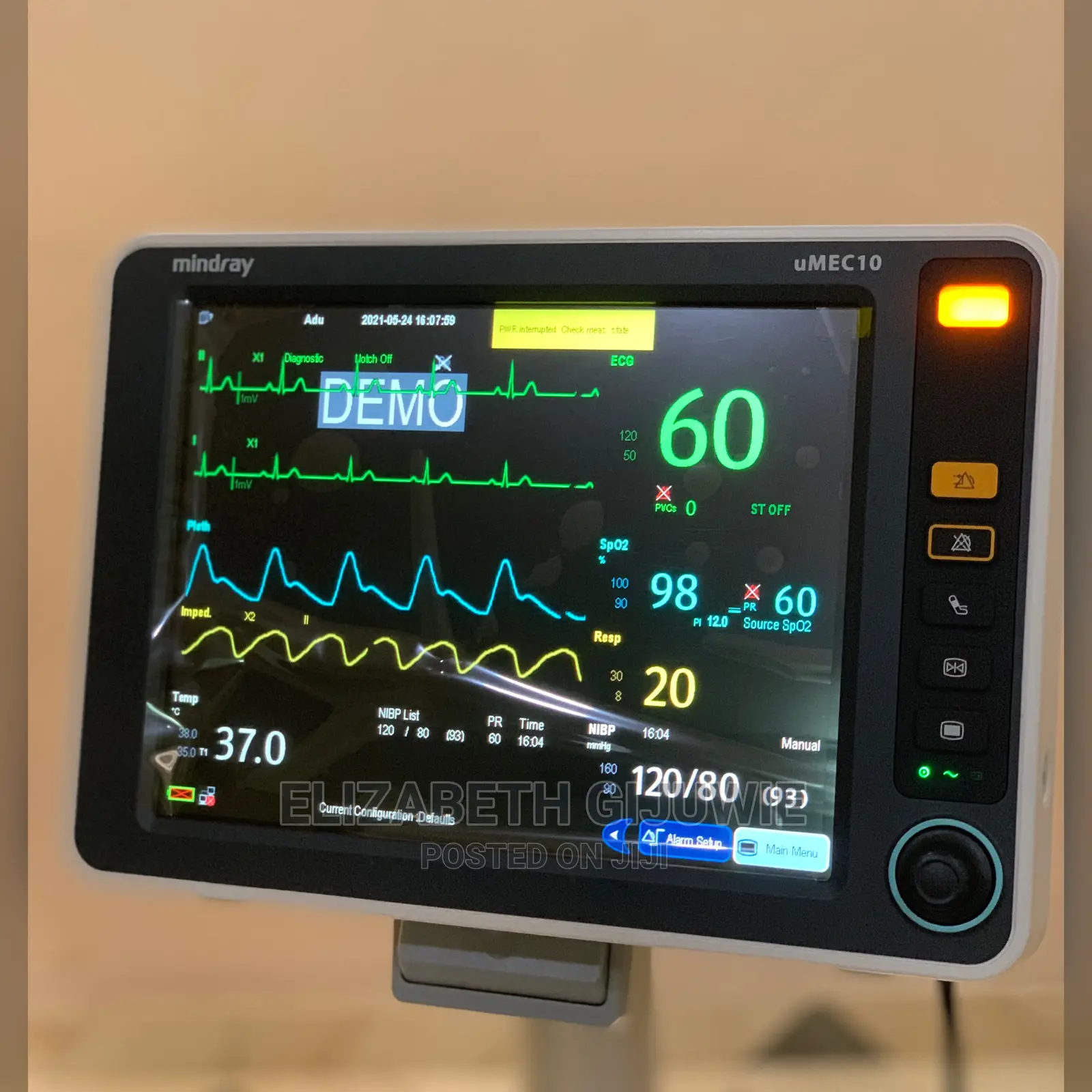 Mindray Patient Monitor