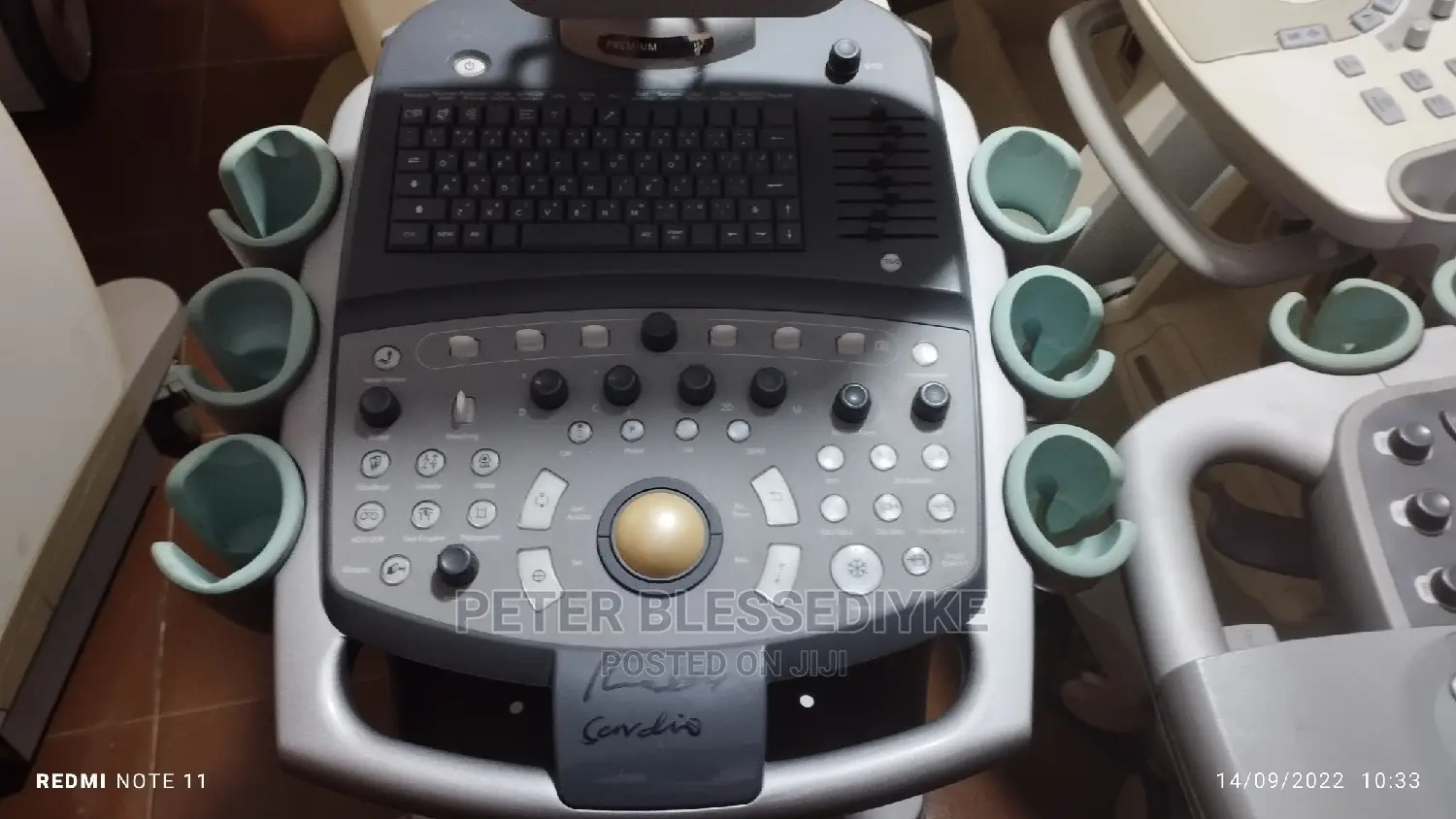 2D Color Doppler Siemens ACUSON X300 (Cardiac)
