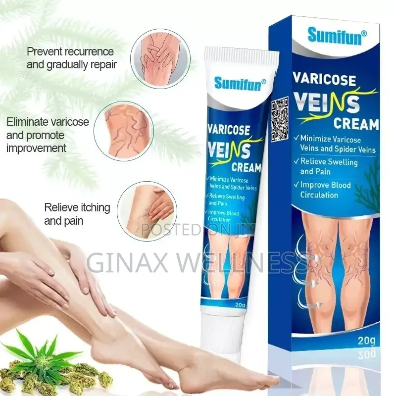 Varicose Veins Cream | Spider Veins Treatment Cream