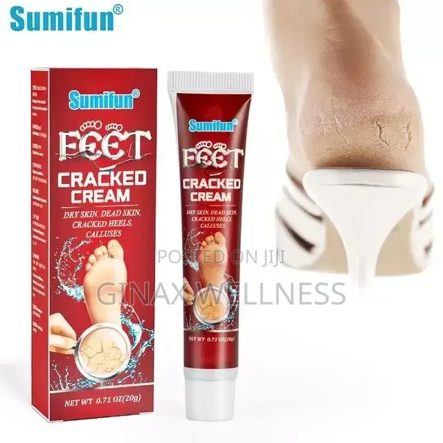 Cracked Cream for Cracked Heels, Dry Skin and Dead Skin