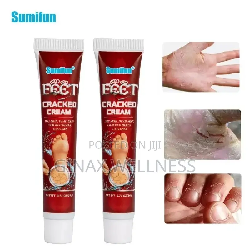 Cracked Cream for Cracked Heels, Dry Skin and Dead Skin
