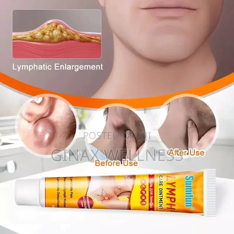 Lymph Care Herbal Ointment for Swollen Lymphatic Nodes