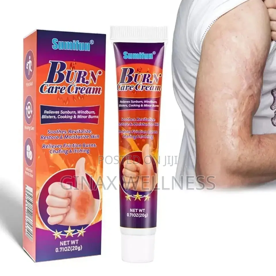 Burn Care Cream | Herbal Cream for Burns, Scalds Blisters