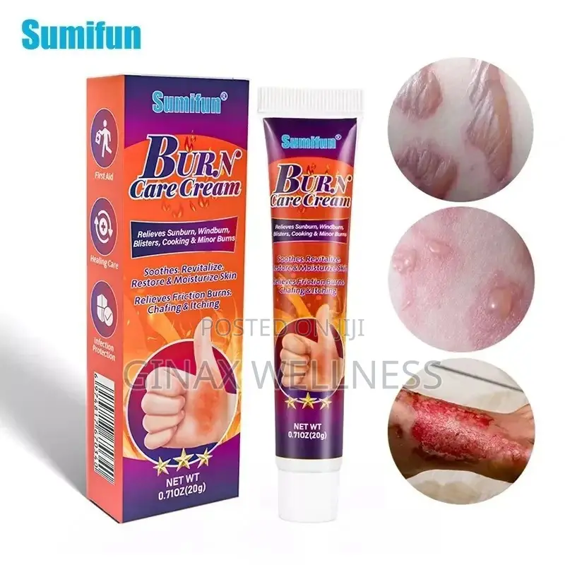 Burn Care Cream | Herbal Cream for Burns, Scalds Blisters