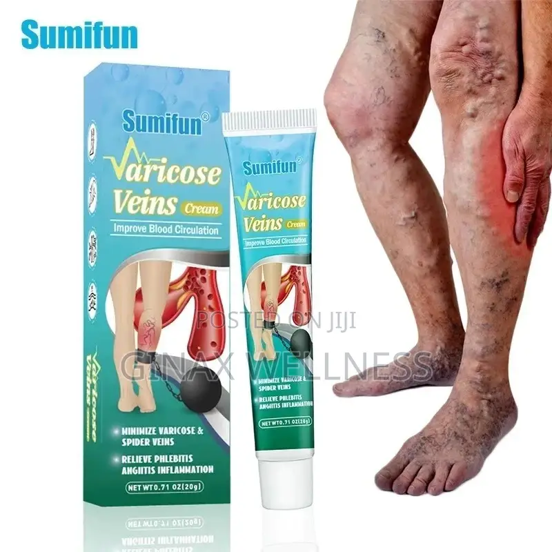 Varicose Veins Relief Cream