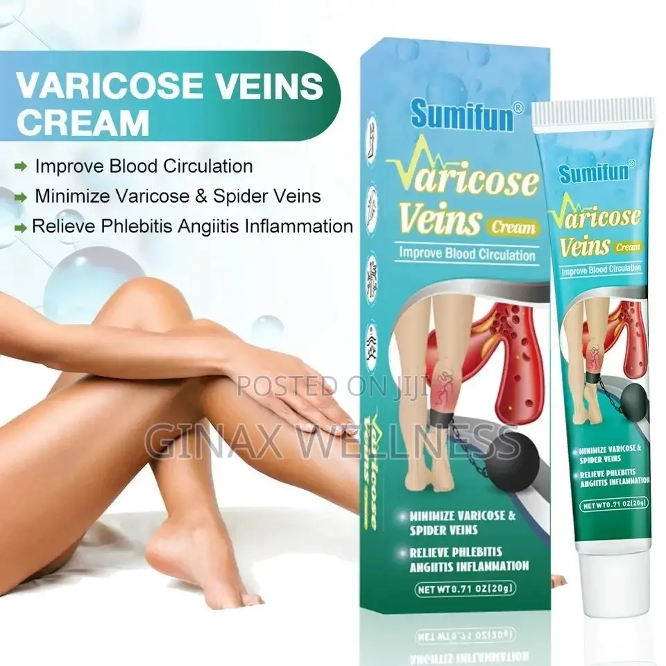 Varicose Veins Relief Cream