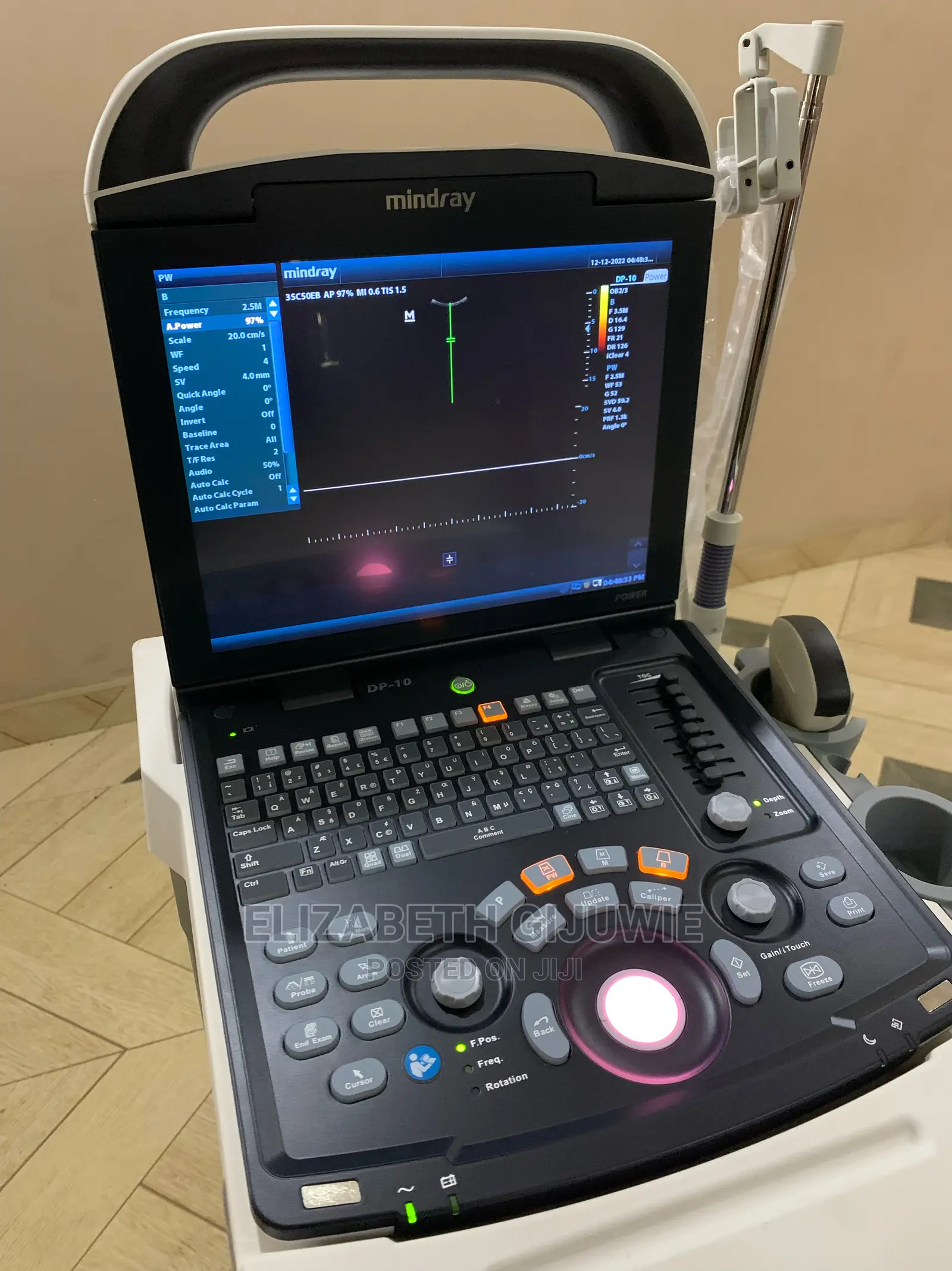 Mindray Dp10 Ultrasound Machine