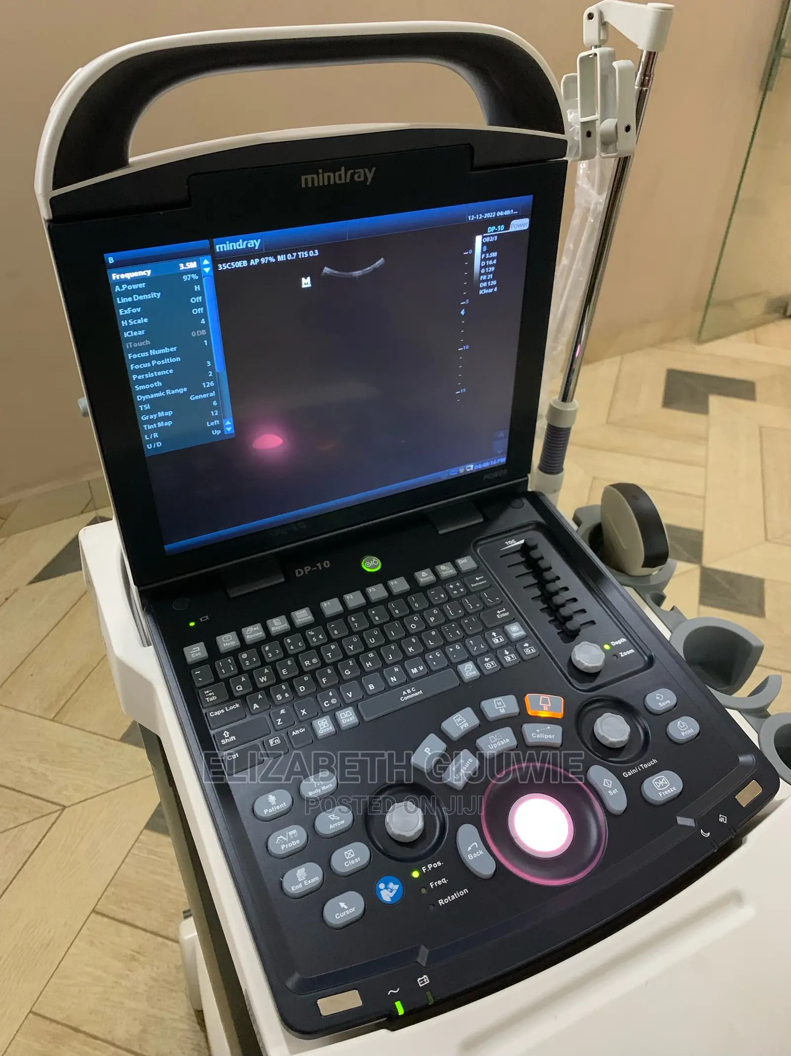 Mindray Dp10 Ultrasound Machine