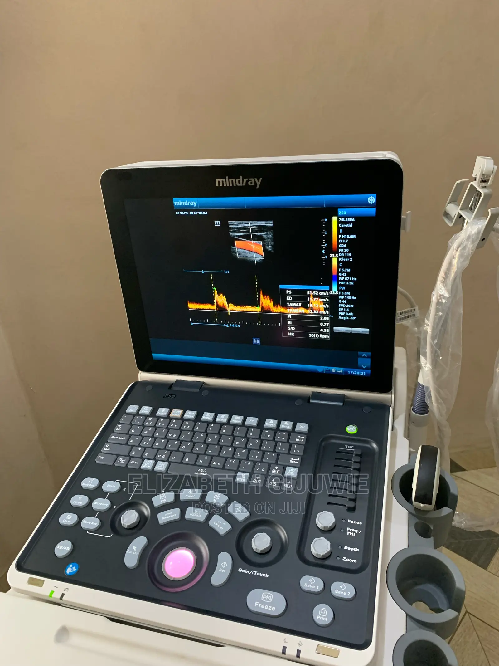 Mindray Z50 Ultrasound Machine