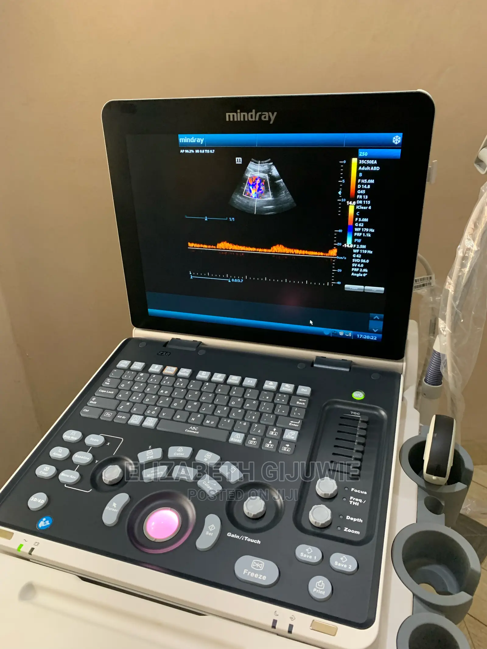 Mindray Z50 Ultrasound Machine