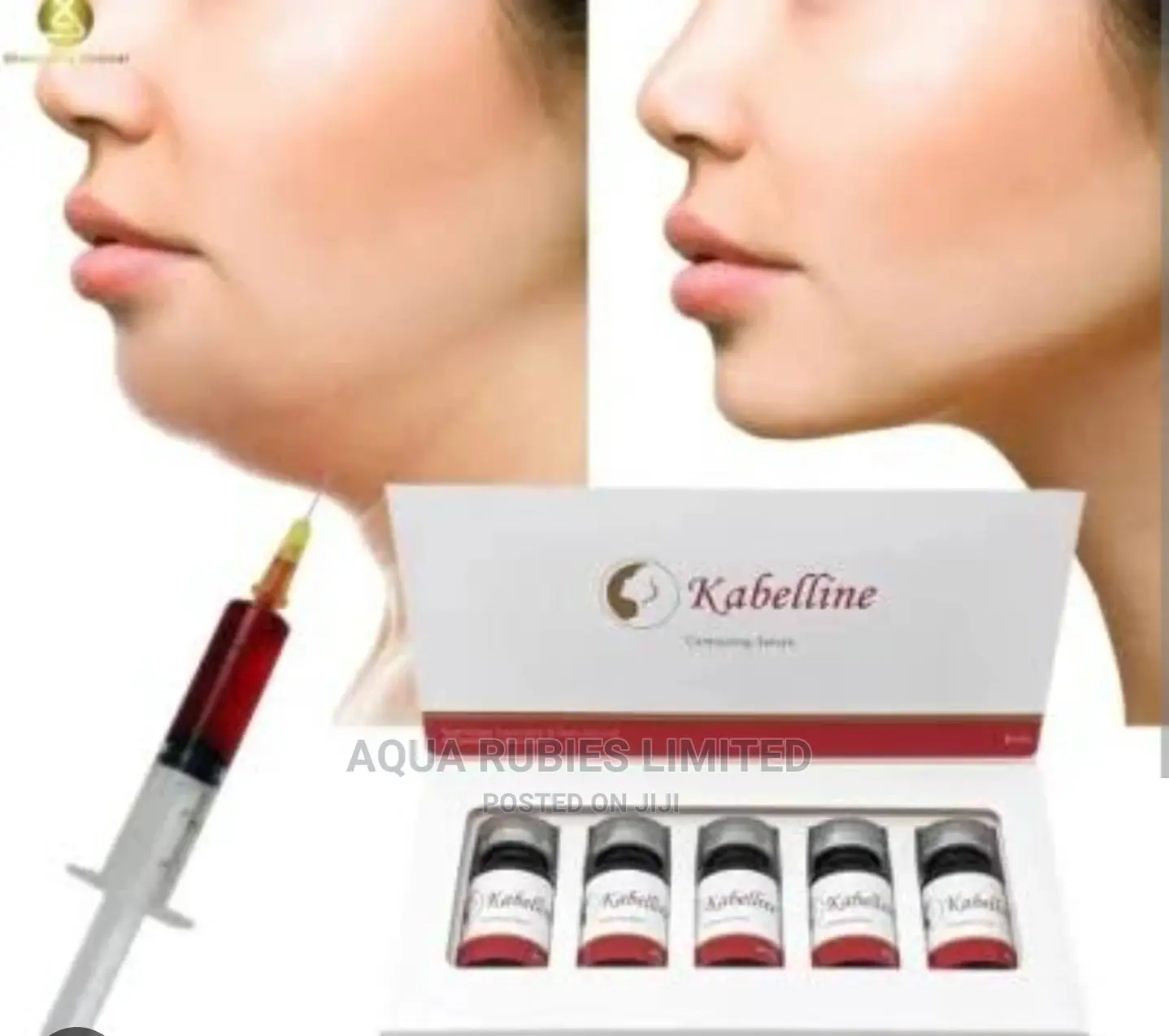 Kabelline Facial Fat Reduction Injection