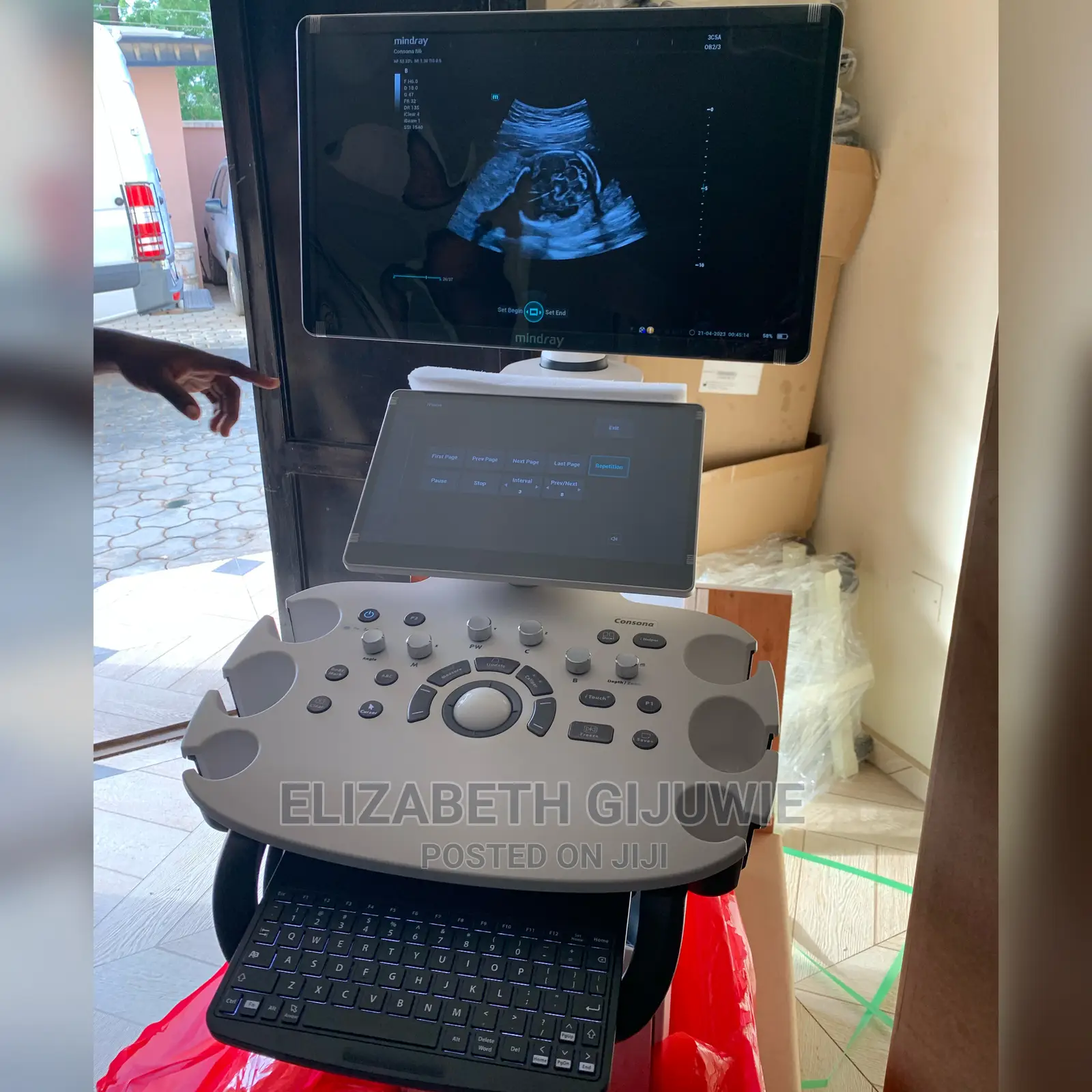 Mindray Consona N6 Ultrasound Machine