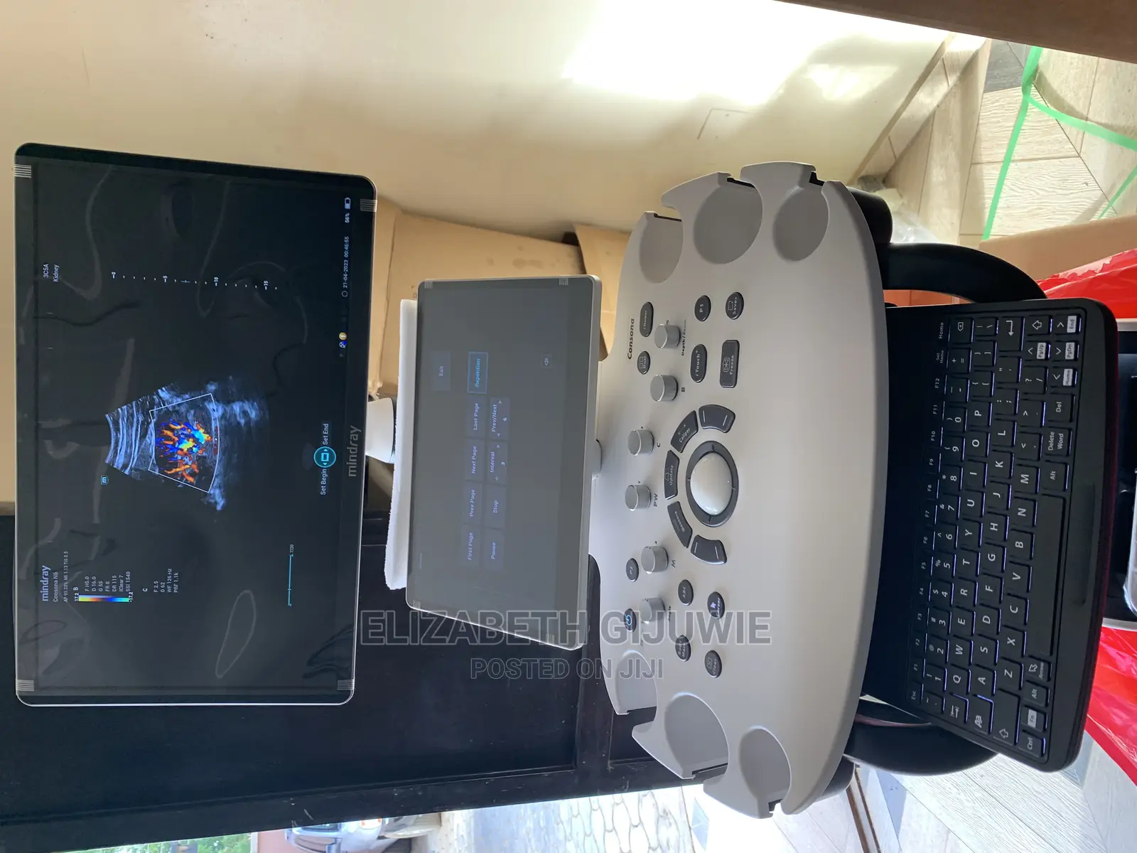 Mindray Consona N6 Ultrasound Machine