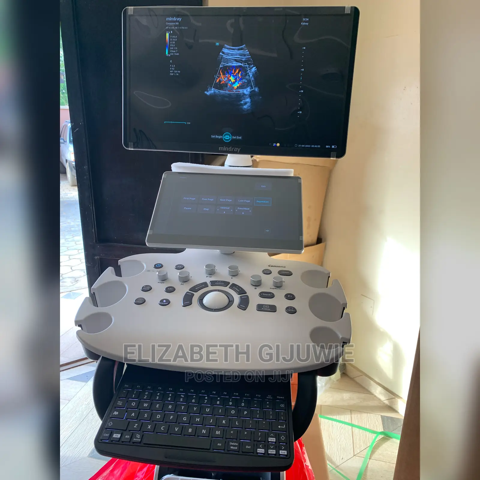 Mindray Consona N6 Ultrasound Machine