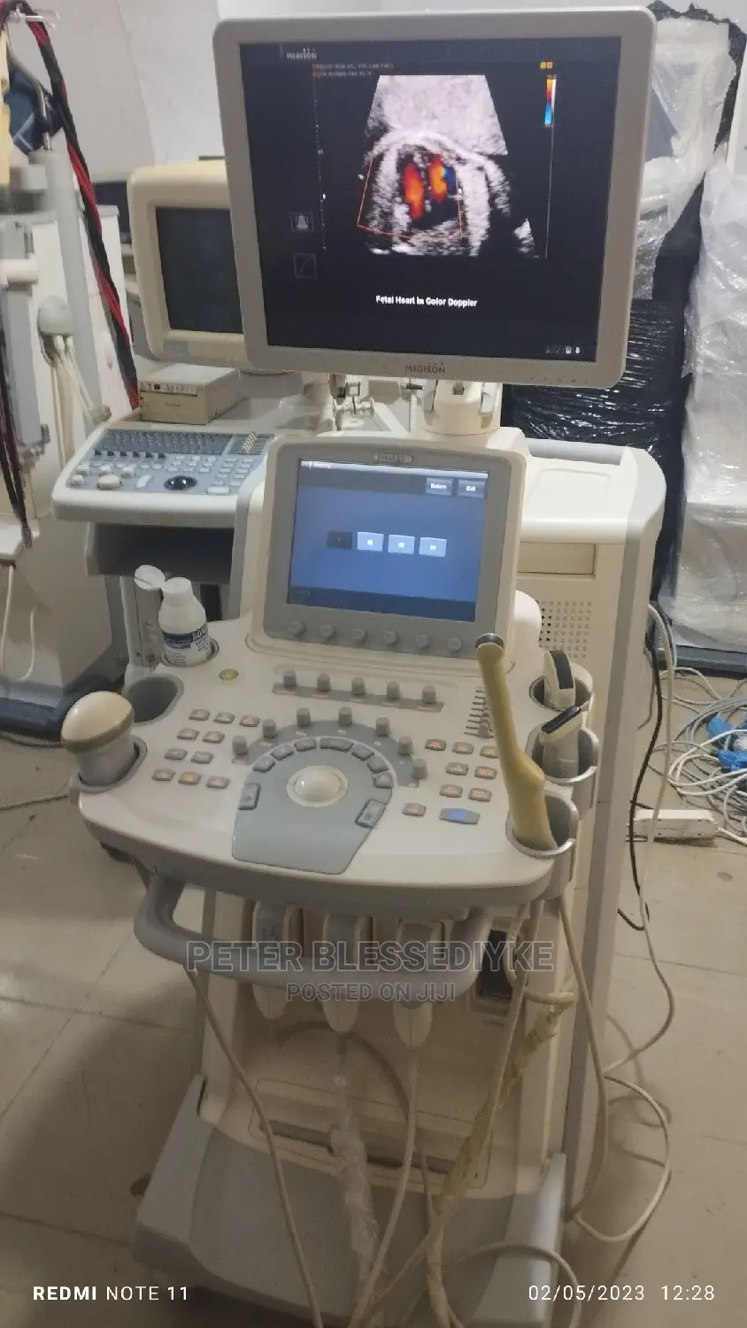 Sonoace Accuvix V20 (3d/4d)