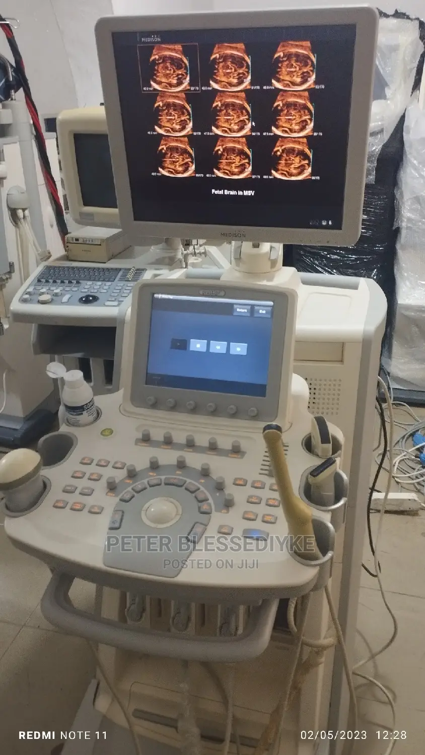 Sonoace Accuvix V20 (3d/4d)