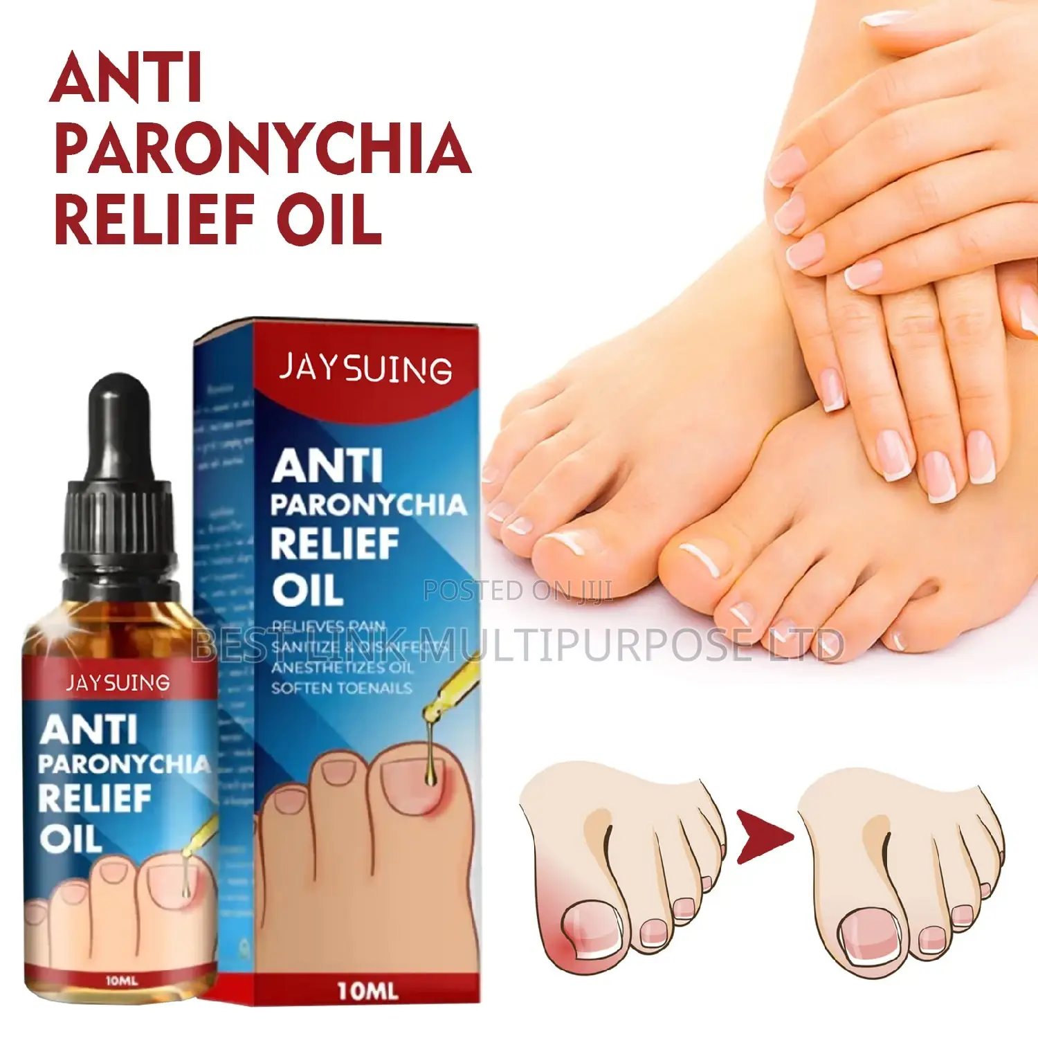 Anti Paronychia Relief Oil