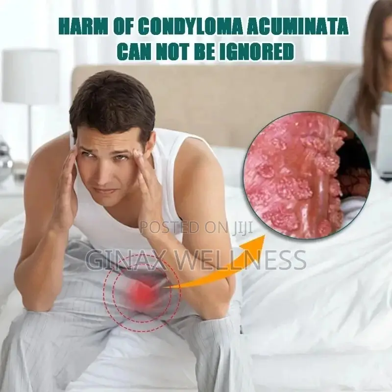 Genital Warts Remover Cream