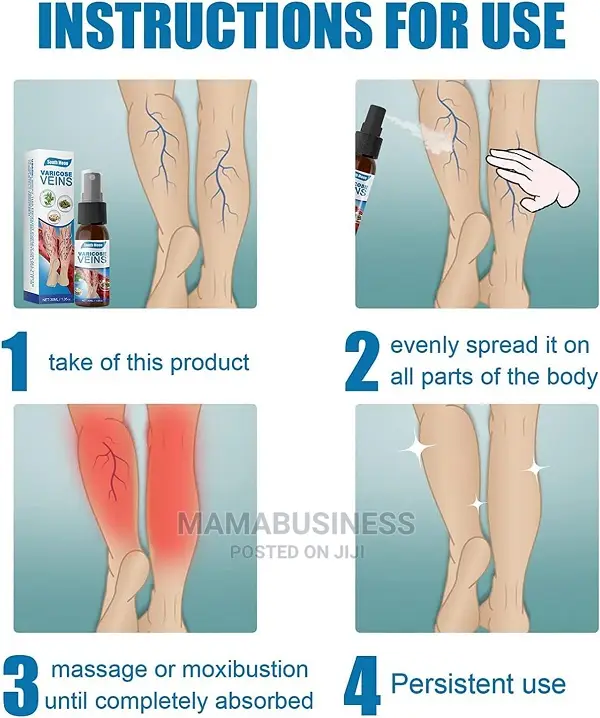 Veinhealing Varicose Veins Spray 30ml
