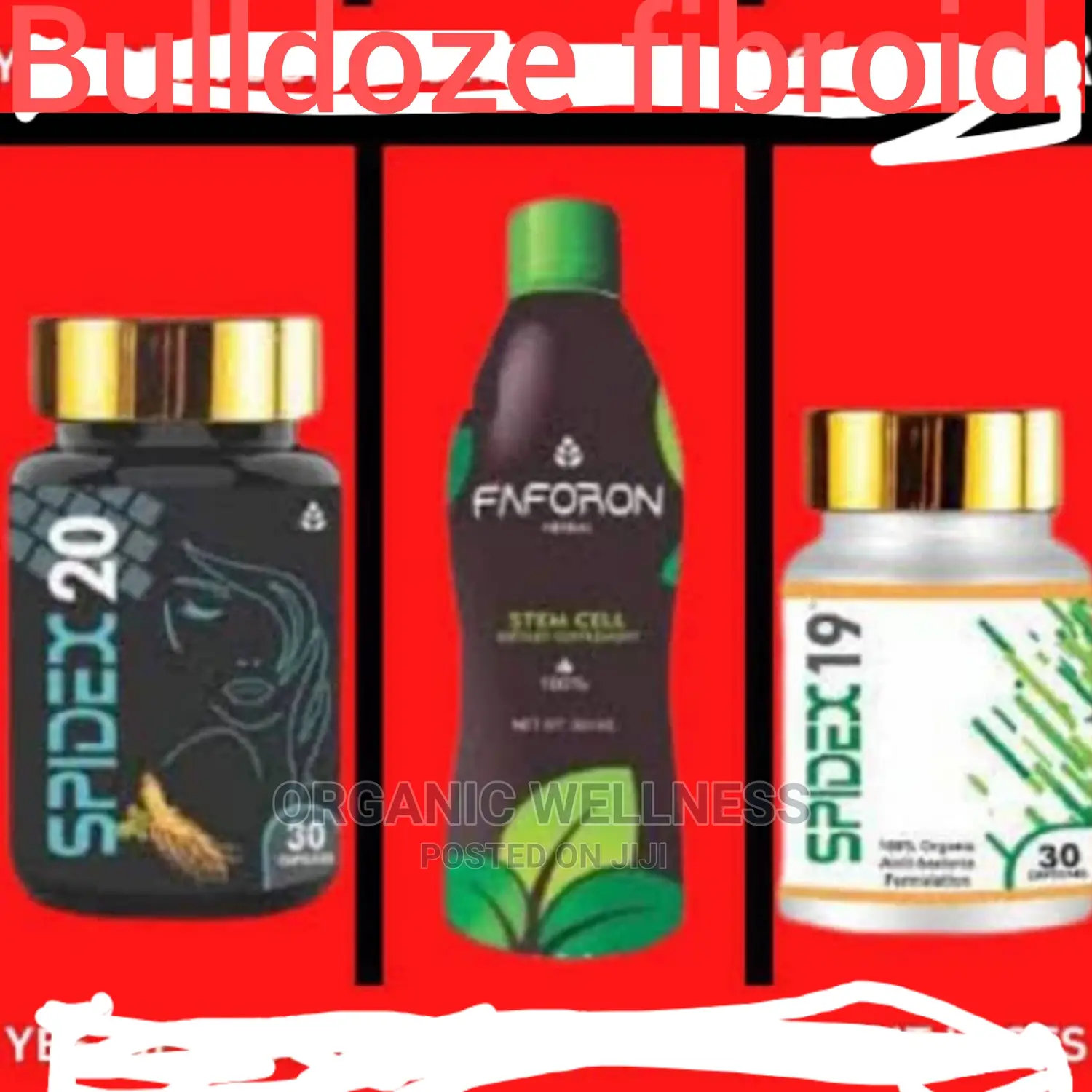Bulldoze Fibroid and Restore Infertility