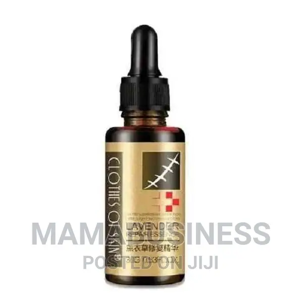 Lavender Repair Essence Stretch Mark Scar Remover