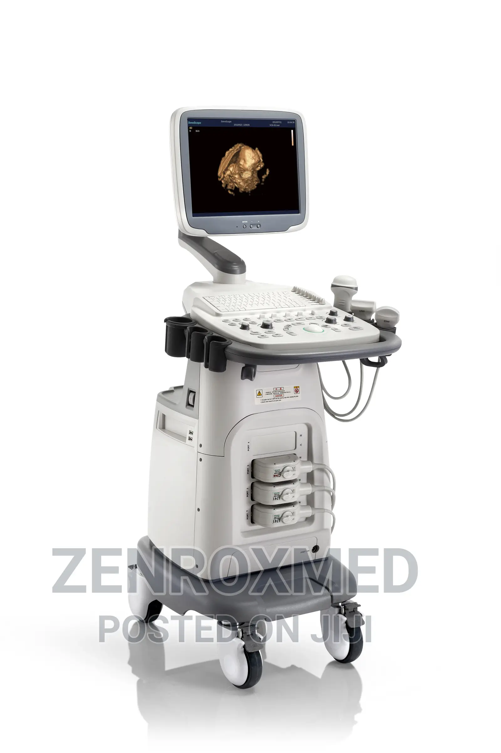 Sonoscape S11 Plus Ultrasound Machine With Two Probes