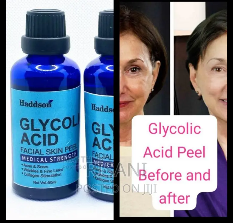 Glycolic Acid Peel