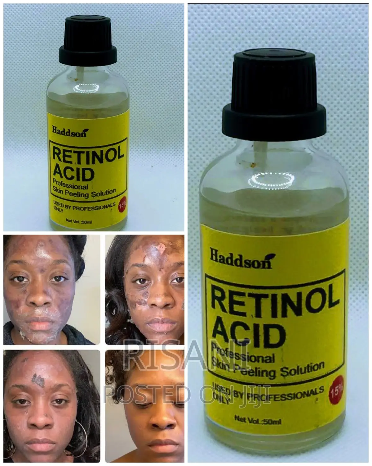 Retinol Professional Chemical Acid Peel