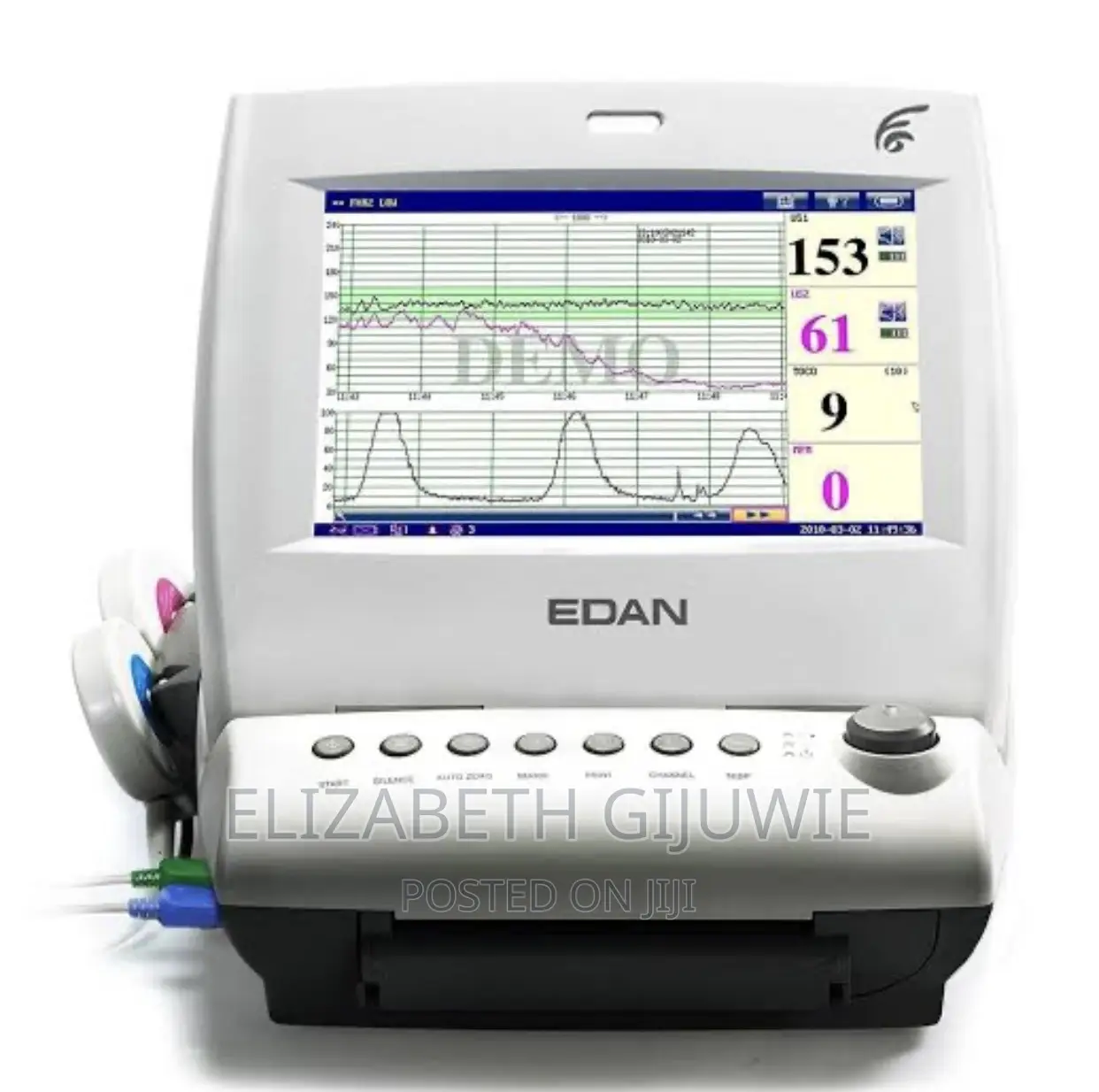 CTG, Cardiotocography Fetal Heart Monitor