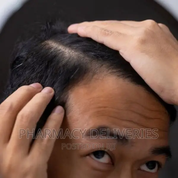 Minoxidil Tablet 10mg for Treatment for Massive Hair Growth