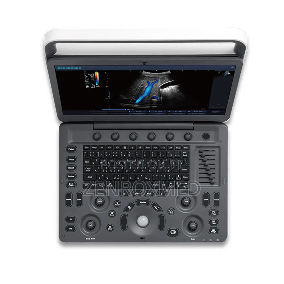 Ultrasound Machine - Sonoscape E2 - Color Ultrasound Scanner