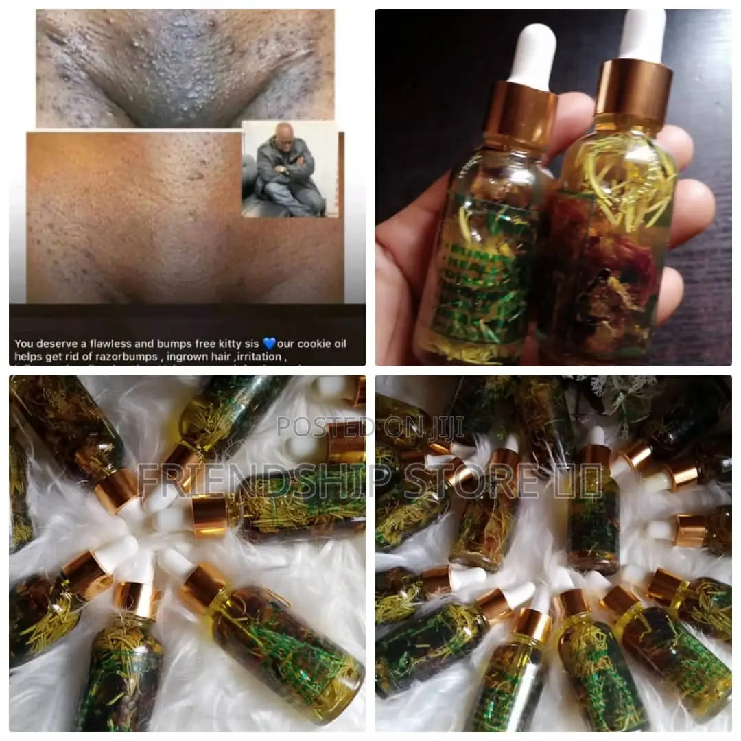Yoni Oil (Skin Care)