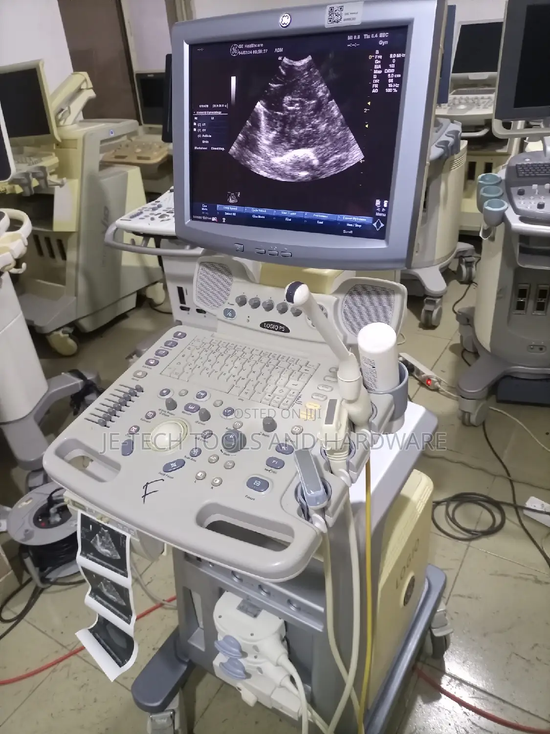 2D GE Logiq P5 Ultrasound ( Color Doppler)