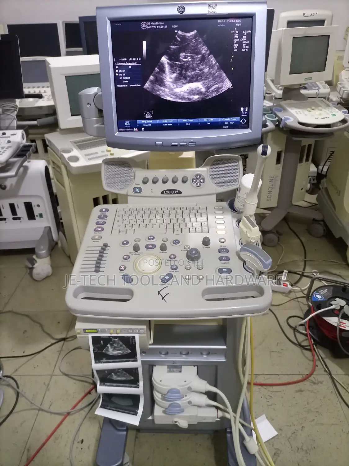 2D GE Logiq P5 Ultrasound ( Color Doppler)