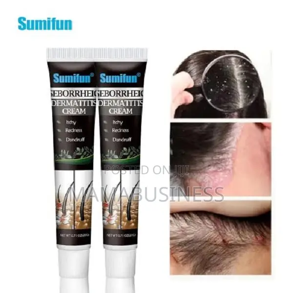 Seborrheic Dermatitis Cream - 20g