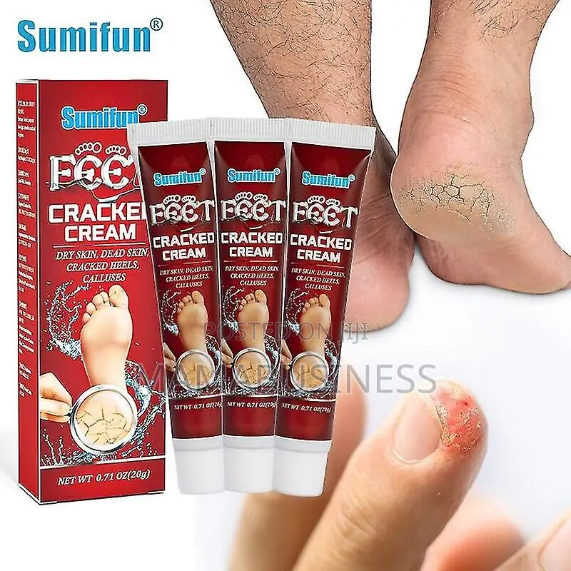 Sumifun Feet Cracked Cream-20g