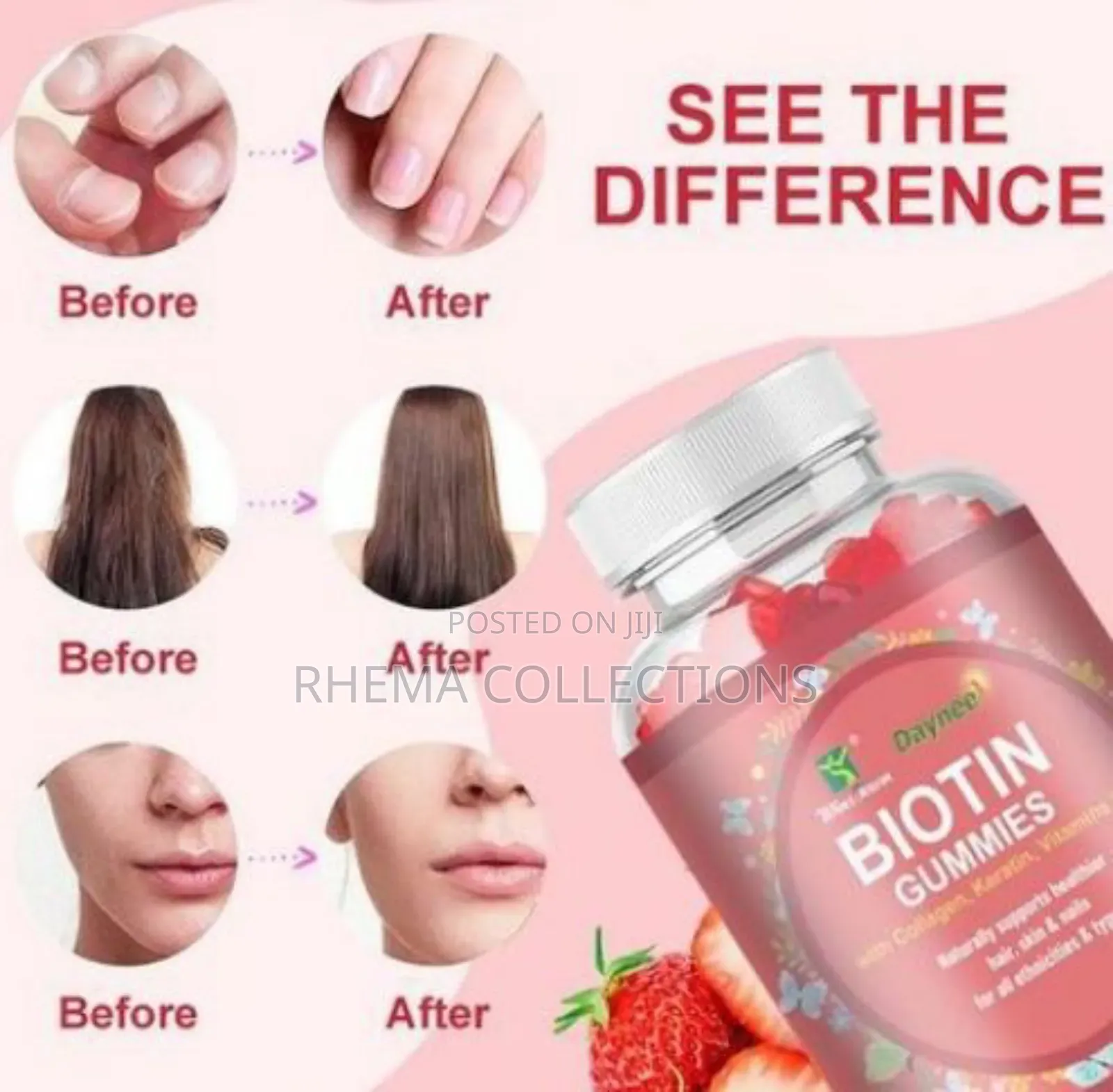 BIOTIN GUMMIES(With Collagen Keratin and Vitamin C