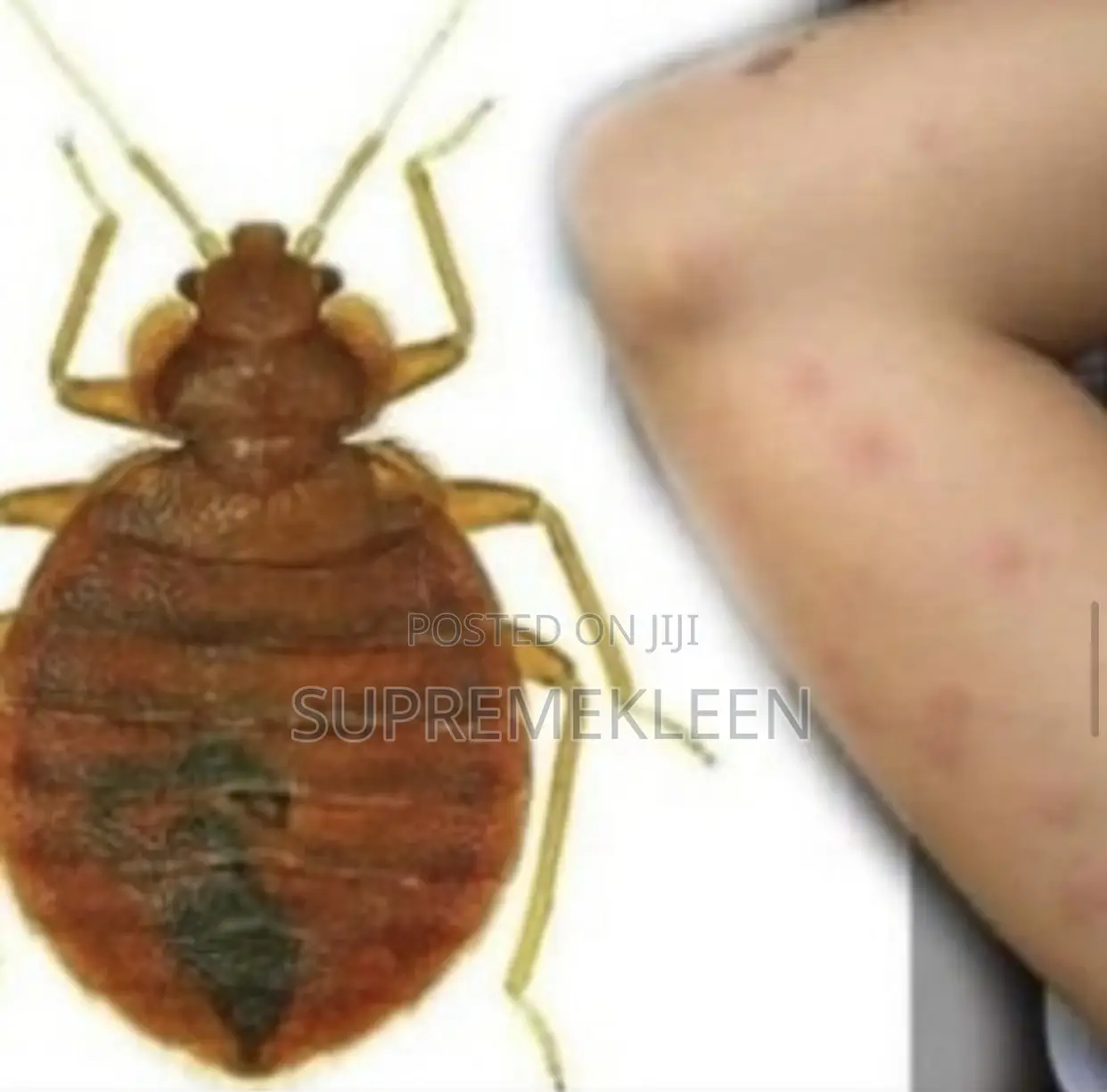 Pest Control of Bedbugs in Your Home