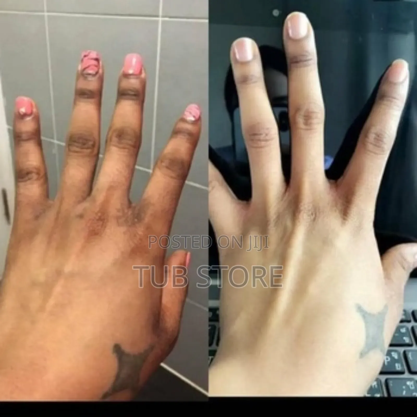 Knuckle Wash and Leg Wash