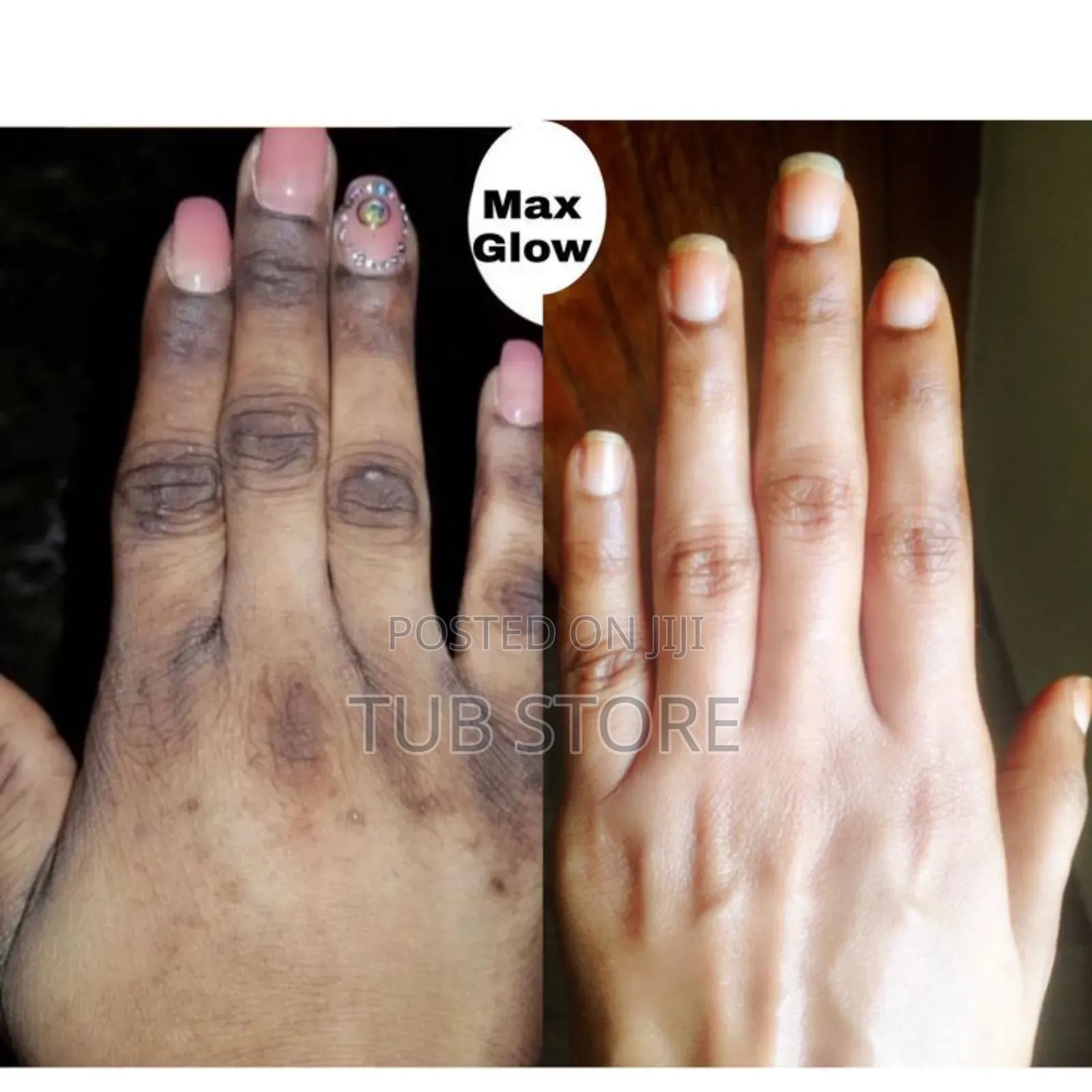 Knuckle Wash and Leg Wash