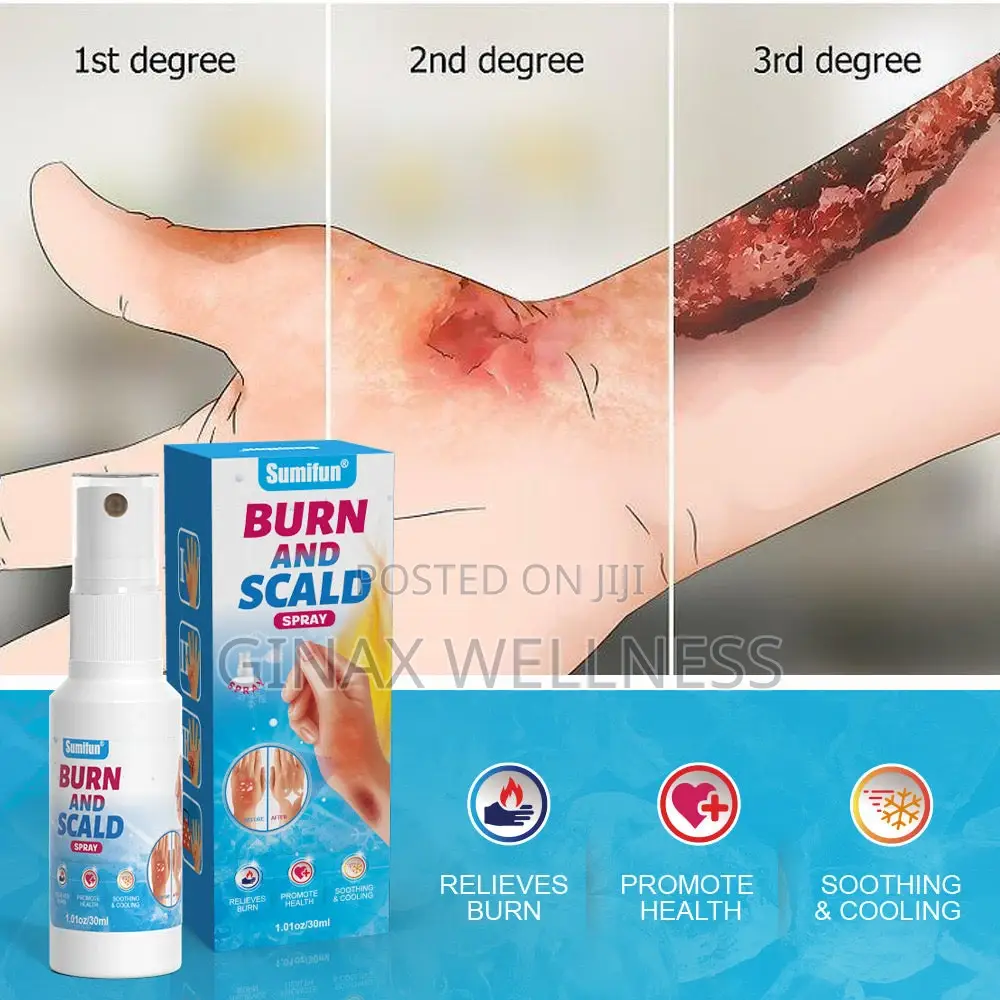 Burn and Scald Spray