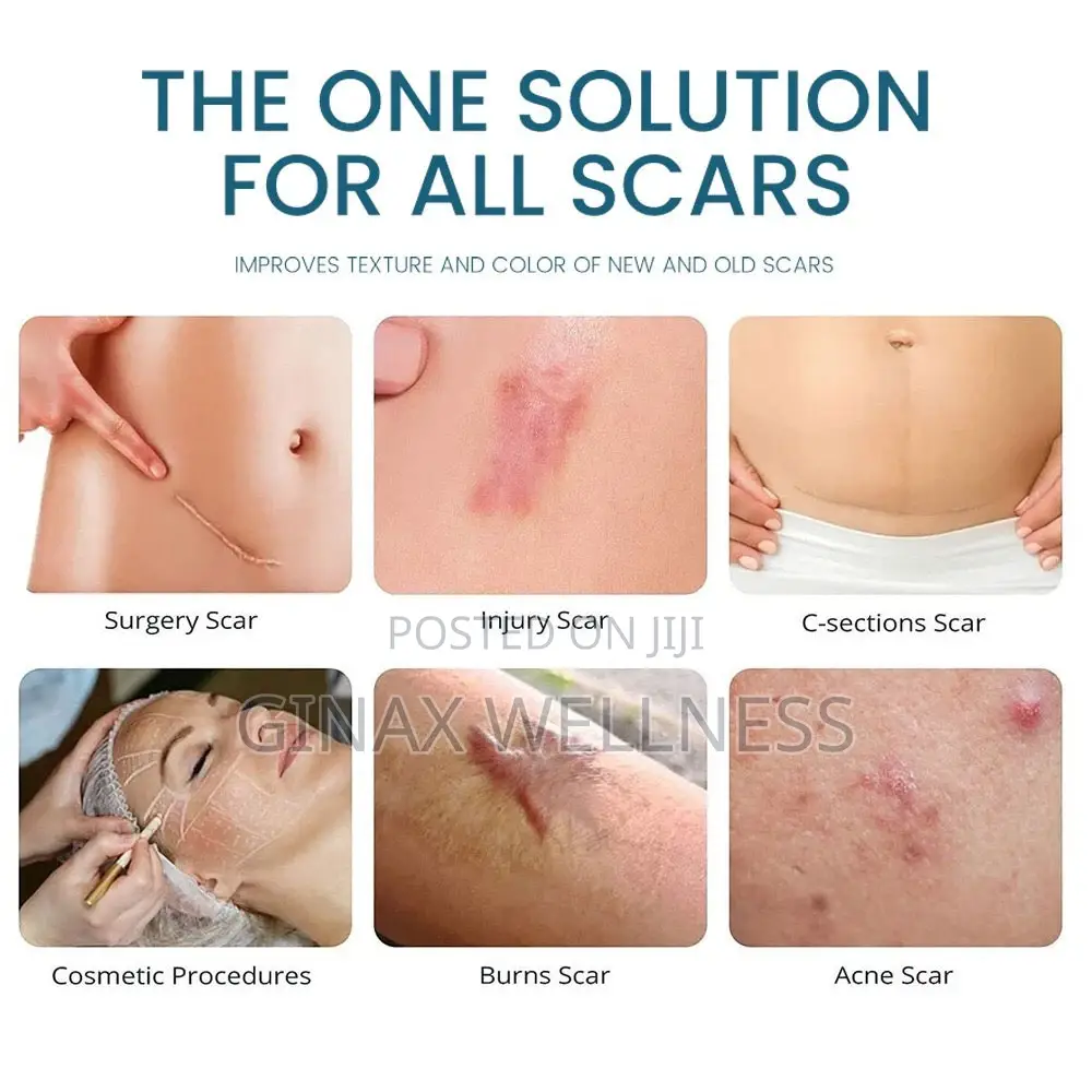 Advanced Scar Gel