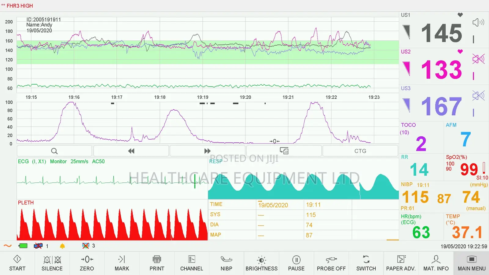 Edan F15 Fetal Maternal Monitor