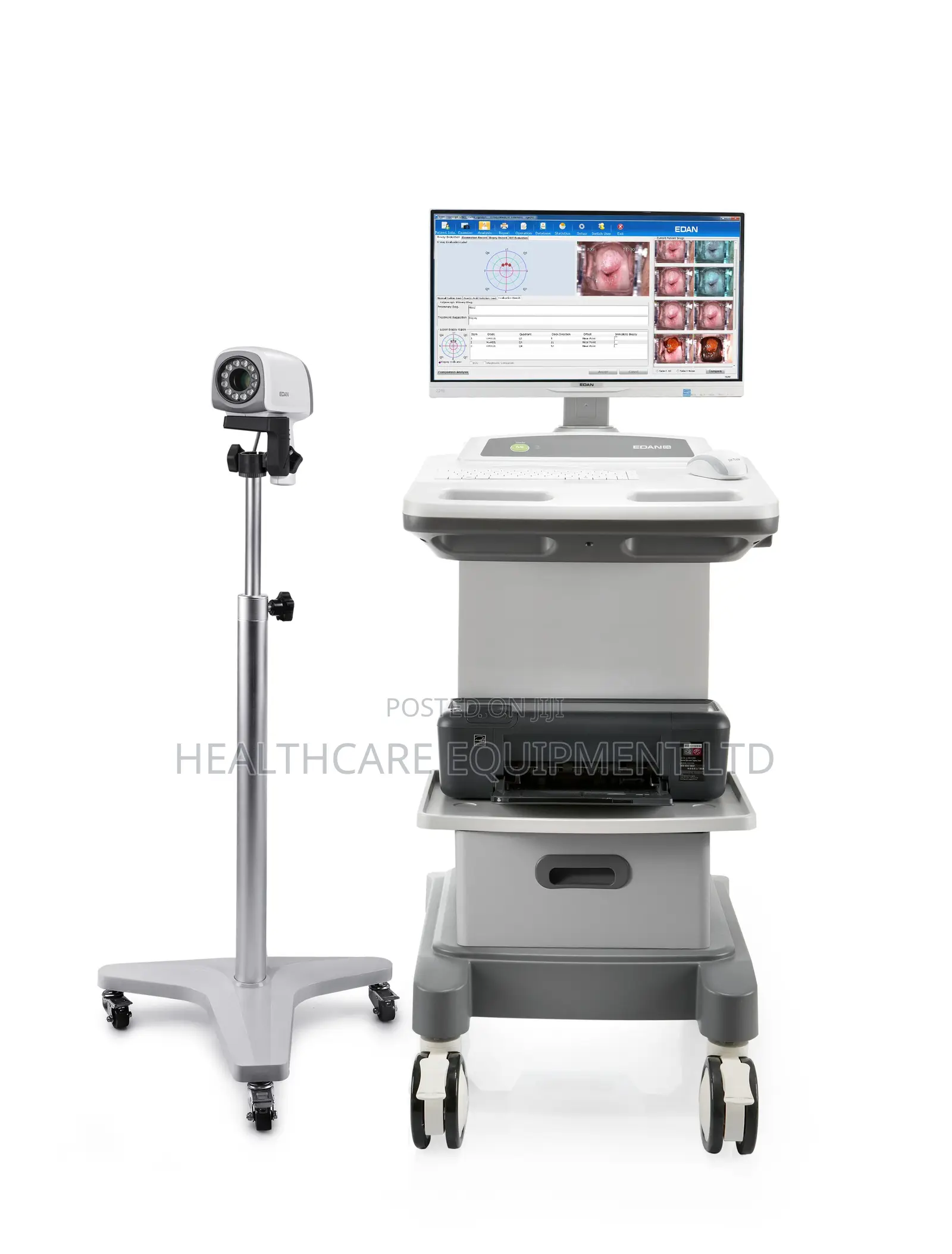 Edan C6 Video Colposcope