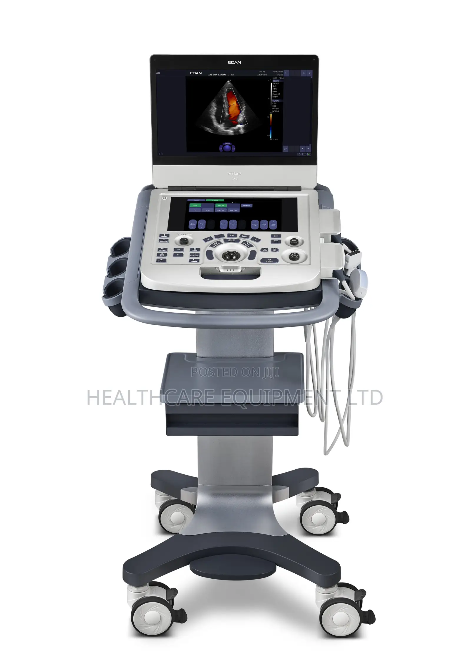 Edan AX3 Diagnostic Ultrasound System 3d/4d