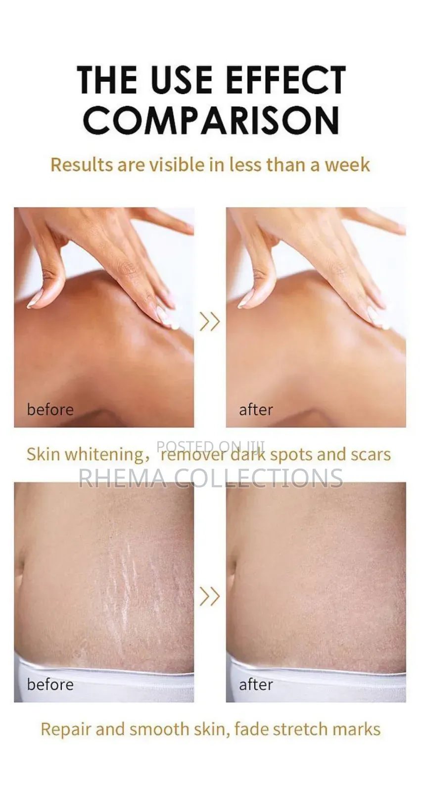 Extra Strong Peeling Oil for Whiten and Smoothen Skin 110ml
