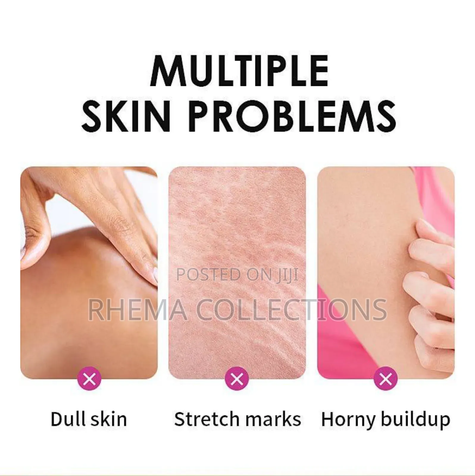 Extra Strong Peeling Oil for Whiten and Smoothen Skin 110ml