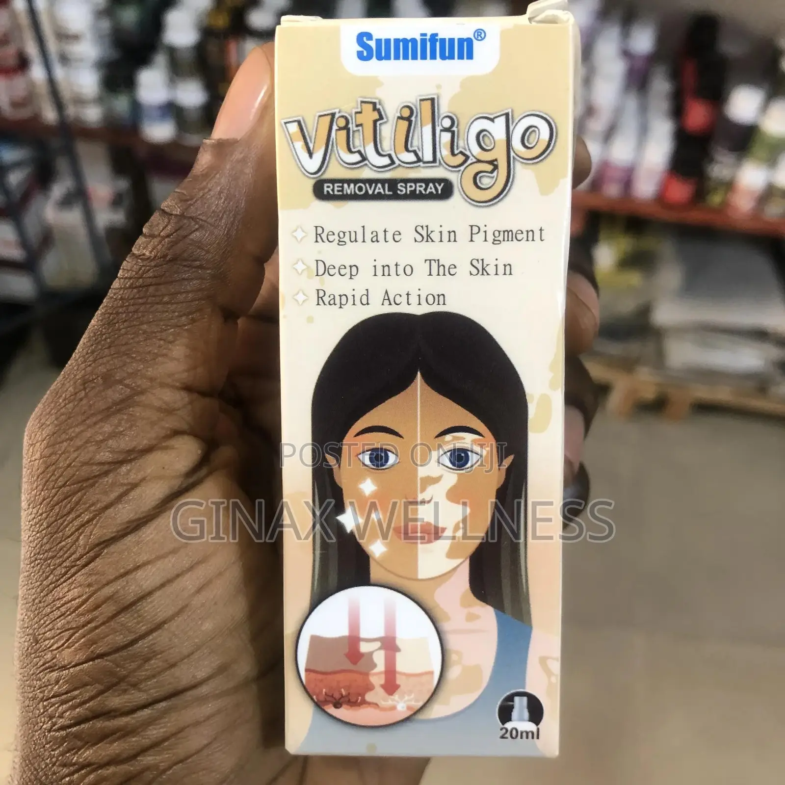 Vitiligo Removal Spray