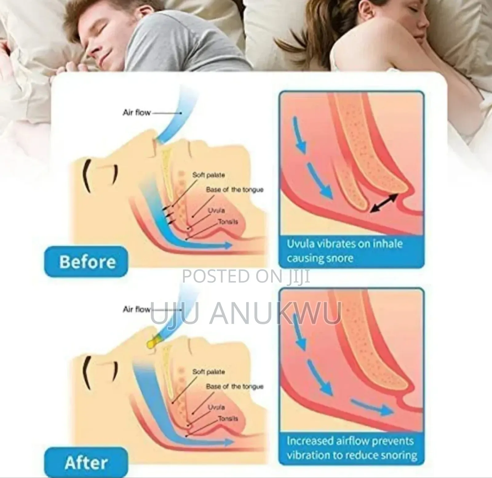 2 In 1soft Silicon Anti Snoring Magnetic Nose Plug