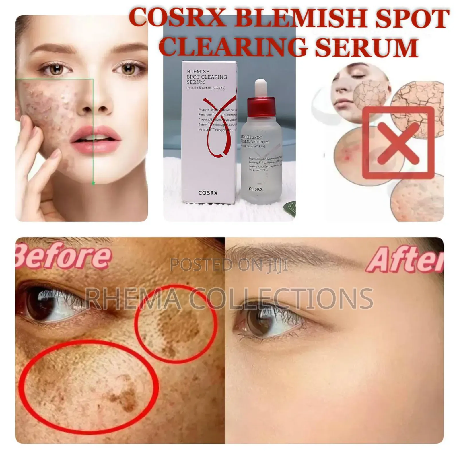 Cosrx Blemish Spot Clearing Serum (40ml)